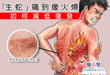 「生蛇」痛到像火燒,如何減低復發 !
