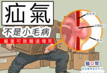 疝氣不是小毛病,嚴重可致腸道壞死