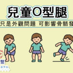 兒童O型腿不只是外觀問題 可影響骨骼發育
