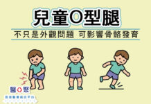 兒童O型腿不只是外觀問題 可影響骨骼發育