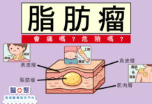 脂肪瘤會痛嗎? 危險嗎?