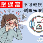 眼壓過高不可輕視,是青光眼先兆