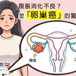 腹脹消化不良?是「卵巢癌」的警號