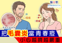 把毛囊炎當青春痘!小心越擠越嚴重!