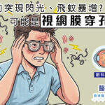 眼前突現閃光、飛蚊暴增? 可能是視網膜穿孔!