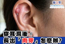 穿耳洞後,長出「肉芽」怎麼辦?